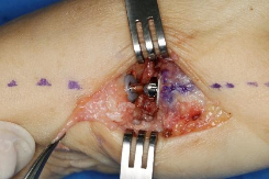 Başparmak Ağrıları