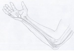 Karpal Tünel Sendromu Tedavisi