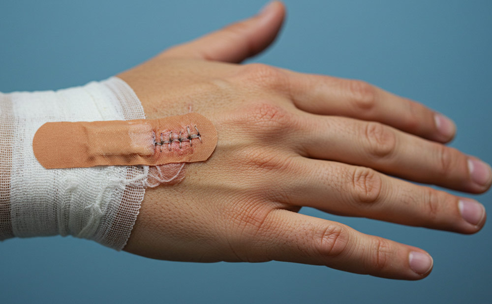 İyileşme Süreci ve Yaralanma Sonrası Bakım